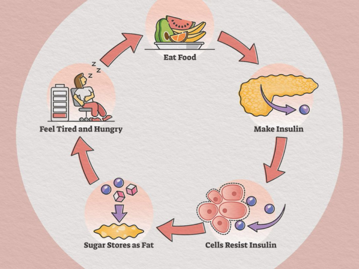 Diabetes Patient Becomes Insulin-Free in Record Time